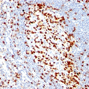 ZAP-70 (Chronic Lymphocytic Leukemia Marker); Clone ZAP70/528 (Concentrate)